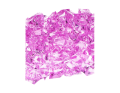 kamyki_akrylowe_myh192571-11_fiolet_roz_2D_0003_large.png
